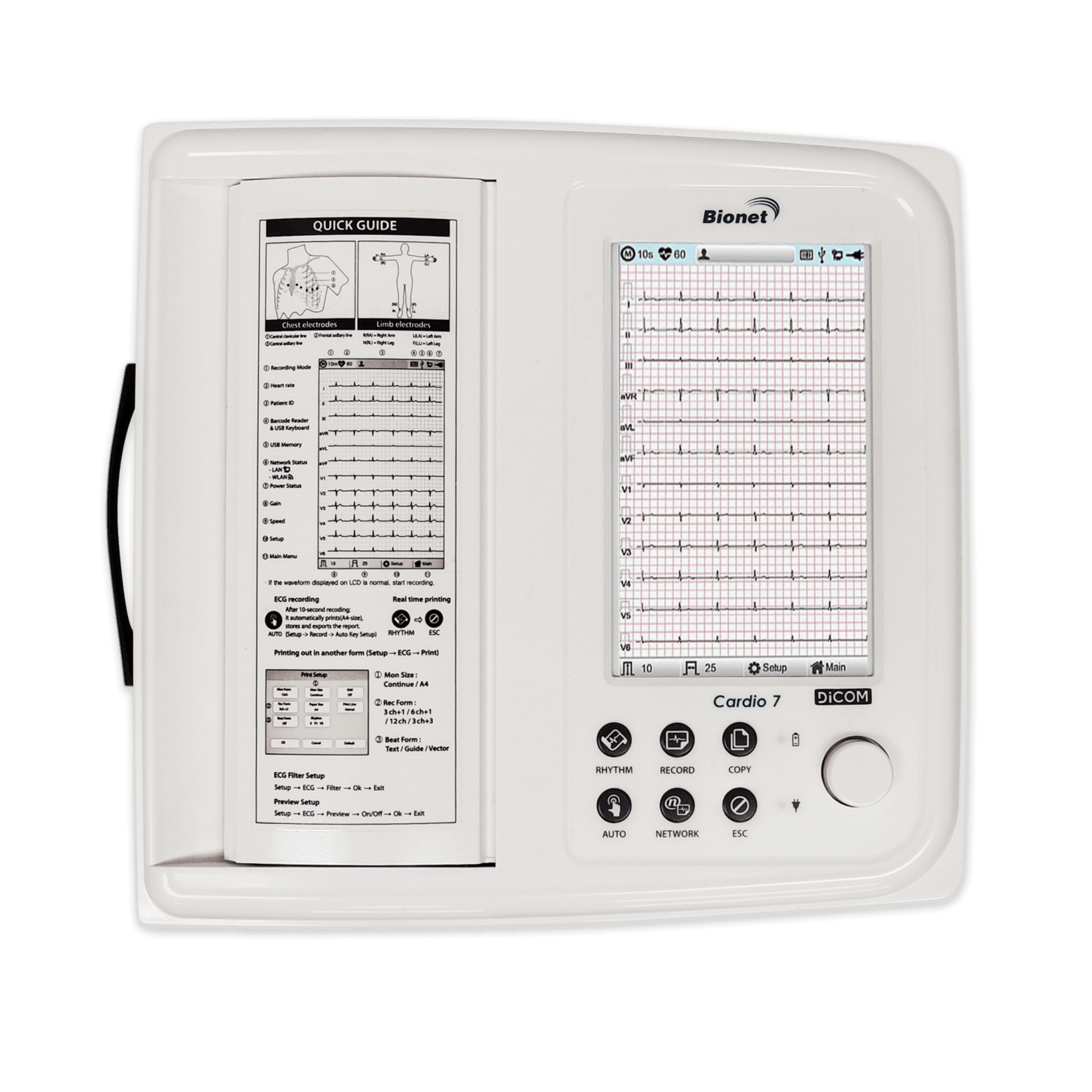 ECG